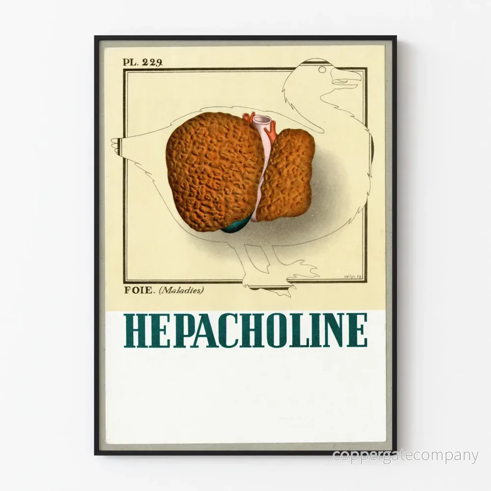 Vintage medicinsk affisch med illustration av levern