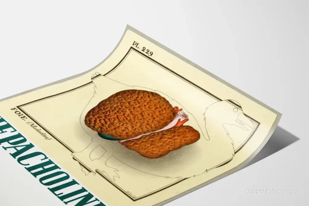 Vintage medicinsk affisch med illustration av levern - Bild 3