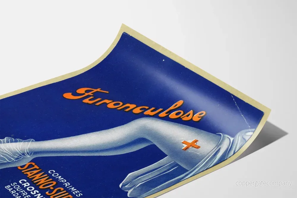 Vintage medicinsk poster för böld och furunculos – fantastisk väggdekoration - Bild 3